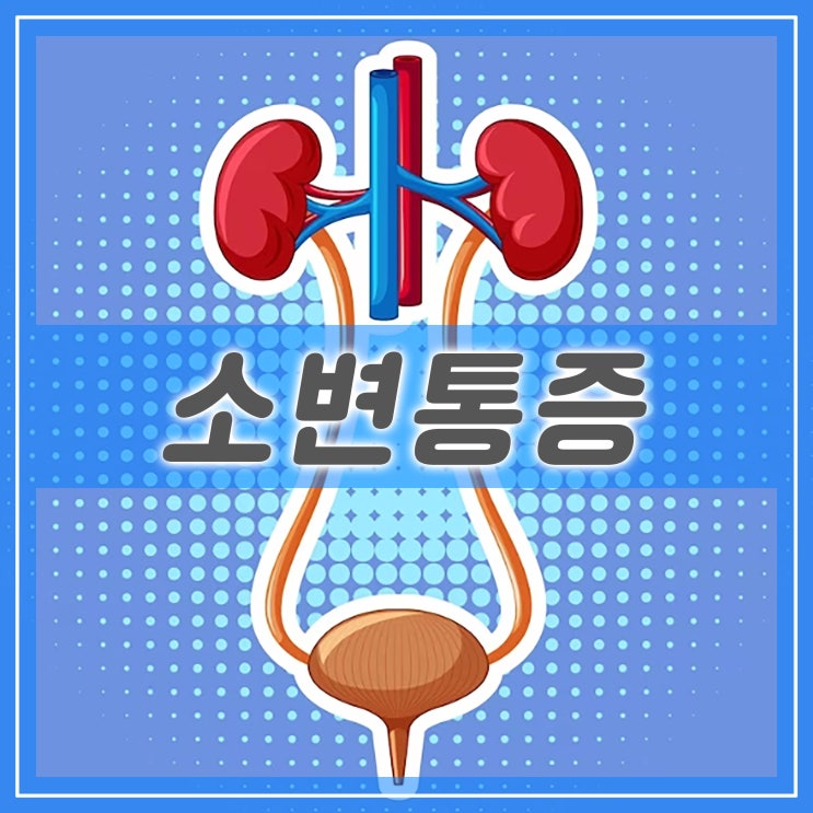  소변볼때 통증, 찌릿 따가움 남자 여자 요도 방광염 문제