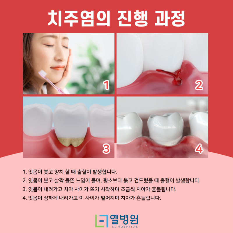 치아건강 통증이 계속된다면 치아건강 통증이 계속된다면