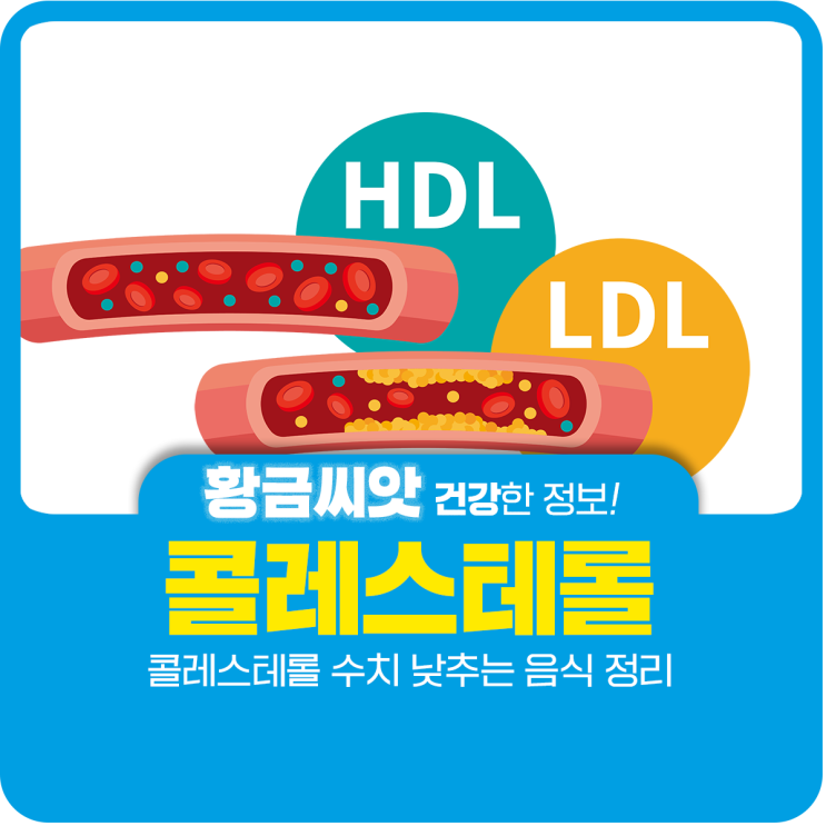 콜레스테롤 수치 낮추는 음식 정리