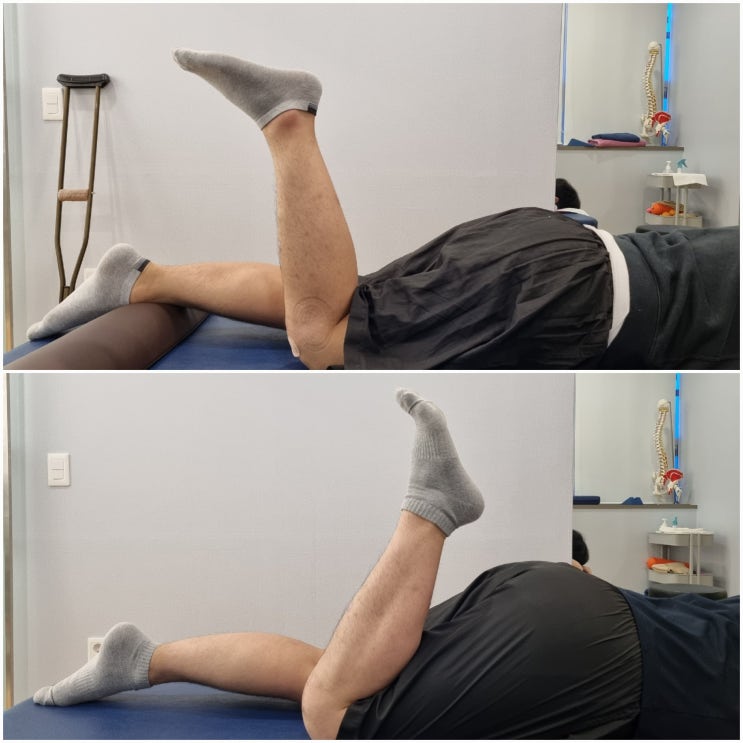 [몸편한재활의학과] 무릎 수술 재활치료 케이스