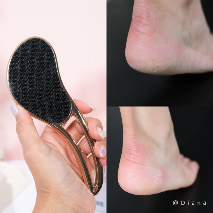 발바닥 발뒷꿈치 발각질제거 블라세아 풋파일 하나로 보들보들 풋케어 발바닥 발뒷꿈치 발각질제거 블라세아 풋파일 하나로 보들보들 풋케어
