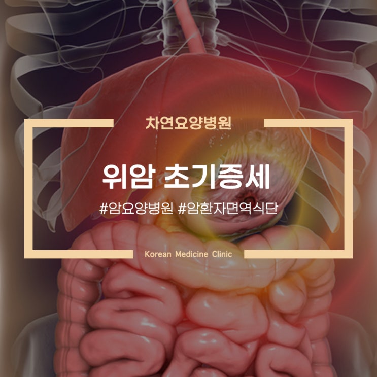  위암 초기증세 속쓰림 소화불량 있다면