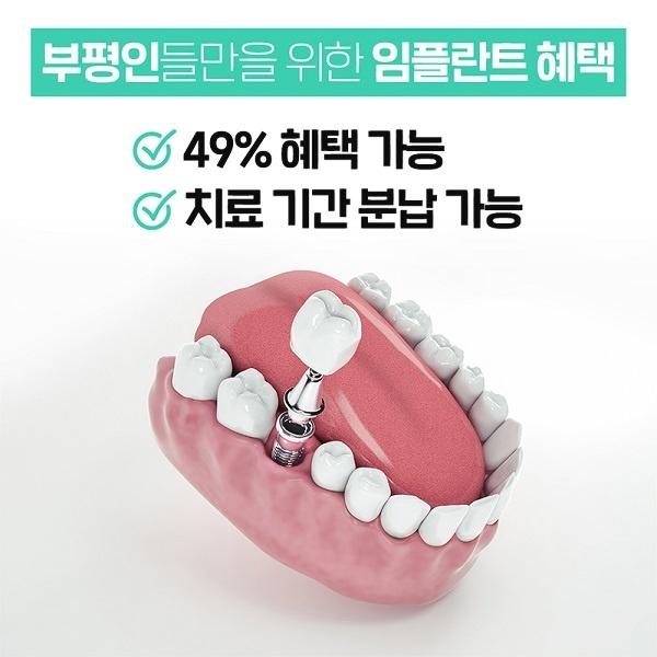  [선착순 모집]강남점치과 부담없는 임플란트 분납가능! 개당 월 19만원