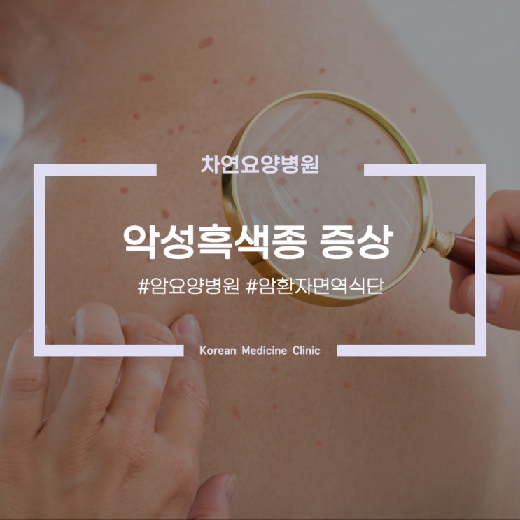  악성흑색종 증상 가장자리 매끄럽지 못한 점