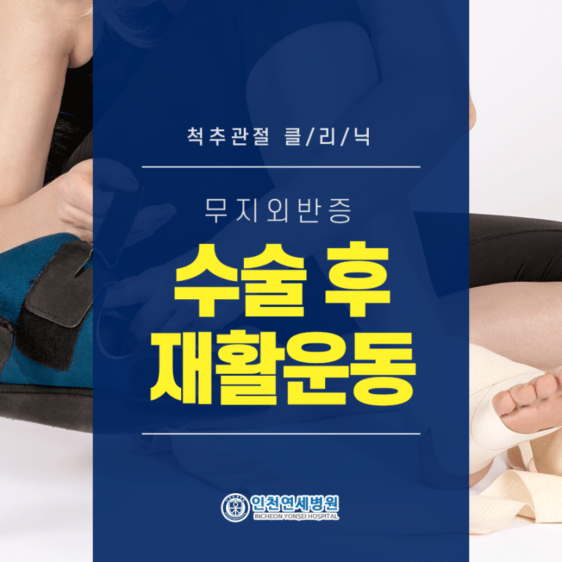 인천무지외반증 수술 후 재활운동이 궁금하신 분들께