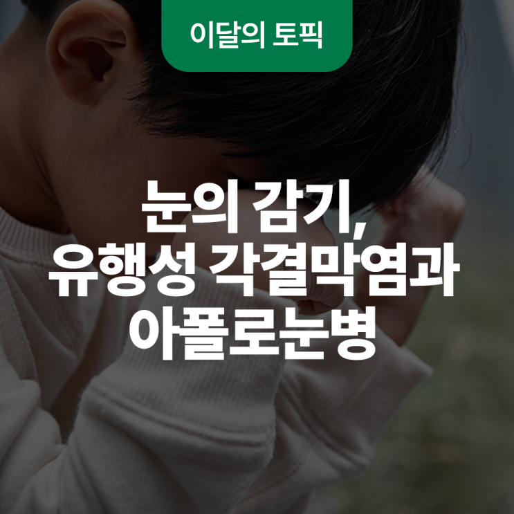  눈의 감기, 유행성 각결막염과 아폴로눈병
