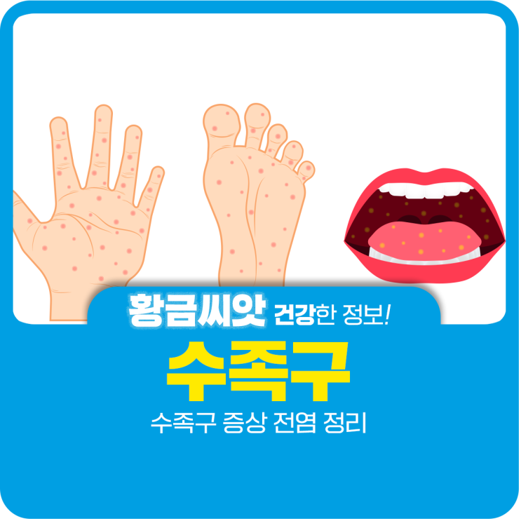  수족구 증상 전염 정리