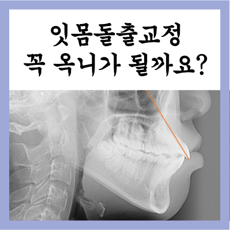  잇몸돌출교정, 정말 옥니가 될까요? 앞니각도에 대해서 (노원교정치과)