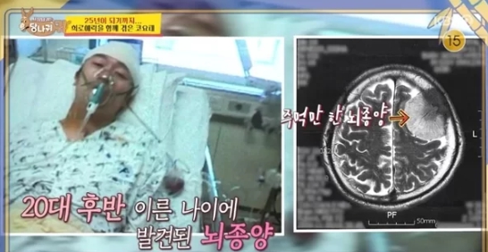 <b>빽가 뇌종양 투병</b> 공황 코요태 리더 강심장 당나귀귀 은지원 뭉찬