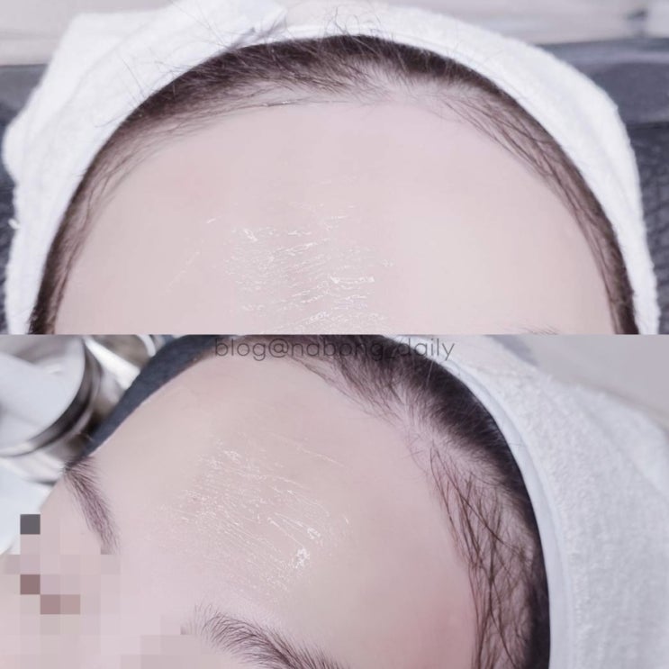 연산동 왁싱 전문 양정 알리왁싱에서 이마 제모 했어요