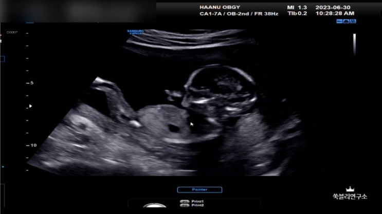 임신 15,16,17주차 증상 사진 영상 똥색깔 변비