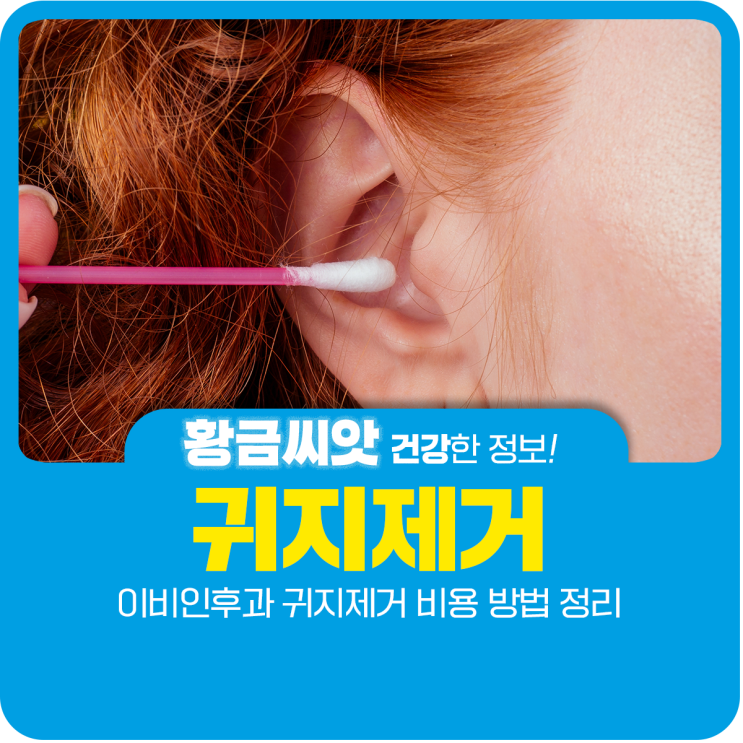  이비인후과 귀지제거 비용 방법 정리