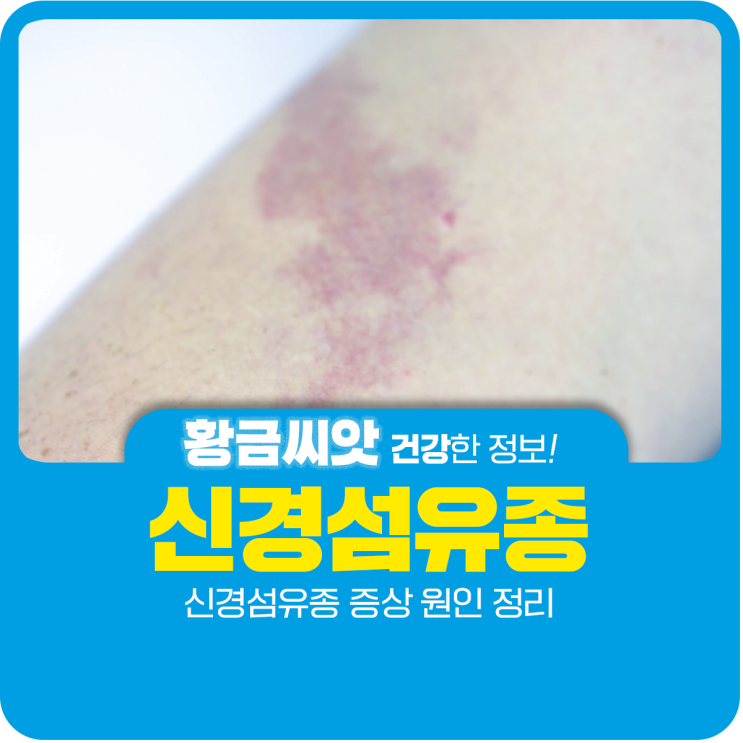  신경섬유종 증상 원인 정리