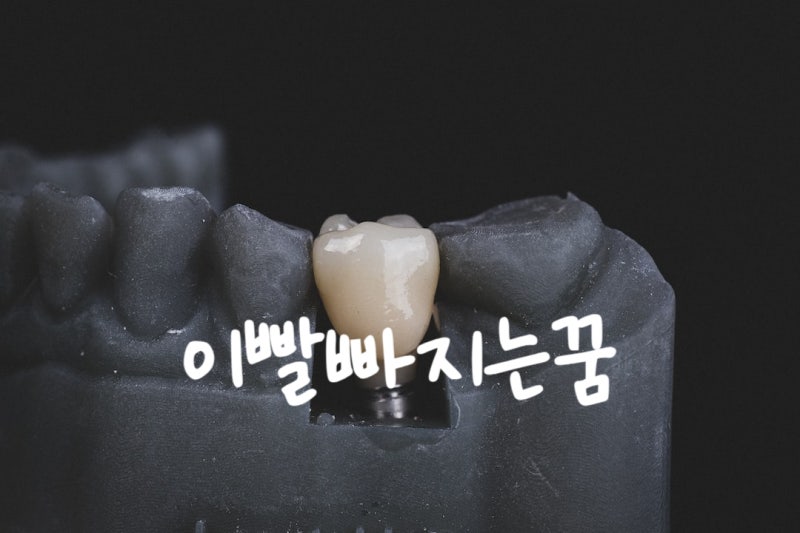 이빨빠지는꿈 썩은이 앞이 금이빨 윗니 아랫니 빠지는 꿈 이빨깨지는꿈 이빨흔들리는꿈