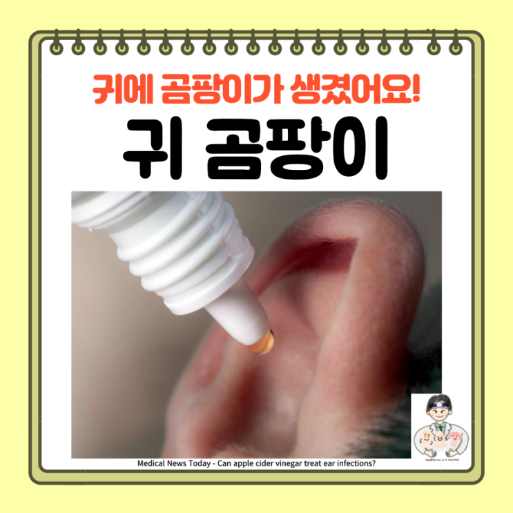  귀 곰팡이, 외이도 진균증, 이진균증(Otomycosis) 원인 증상 치료