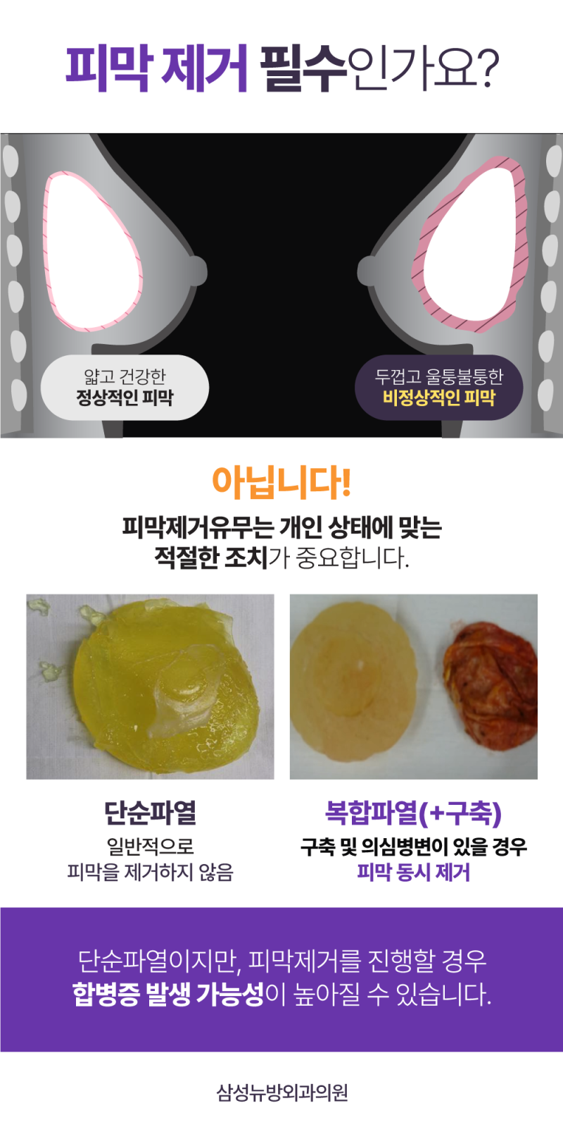 가슴보형물제거 과정 실제 사례로 살펴봐요 : 네이버 블로그