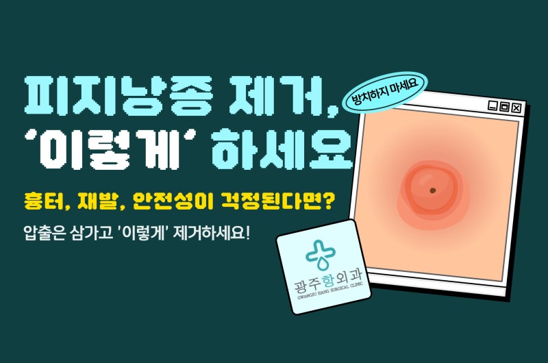 경기도광주피지낭종 제거 '이렇게' 하면 좋습니다
