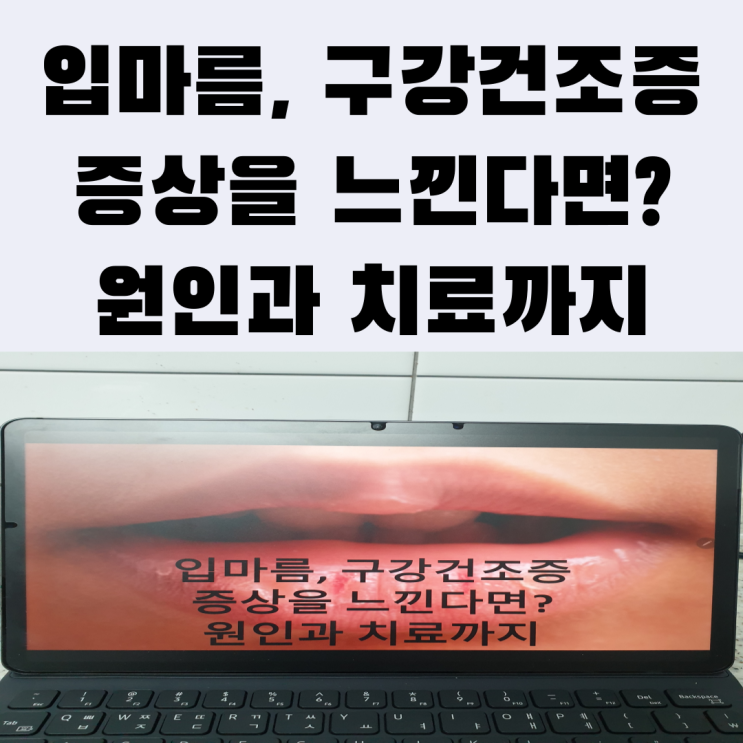  입마름, 구강건조증 증상을 느낀다면? 원인과 치료까지