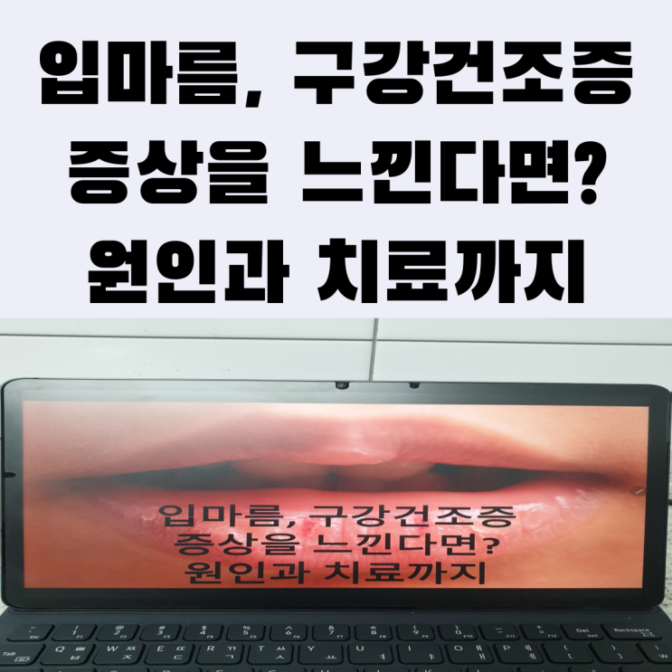 입마름, 구강건조증 증상을 느낀다면? 원인과 치료까지