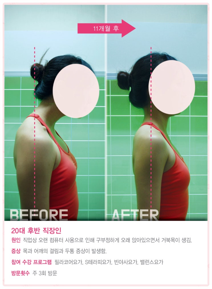  선유도역 필라테스ㅣ만성 피로 어깨결림 두통 관리 방법