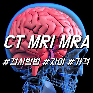 뇌 MRI, MRA 차이 & 머리 CT 촬영, 검사 방법 및 가격