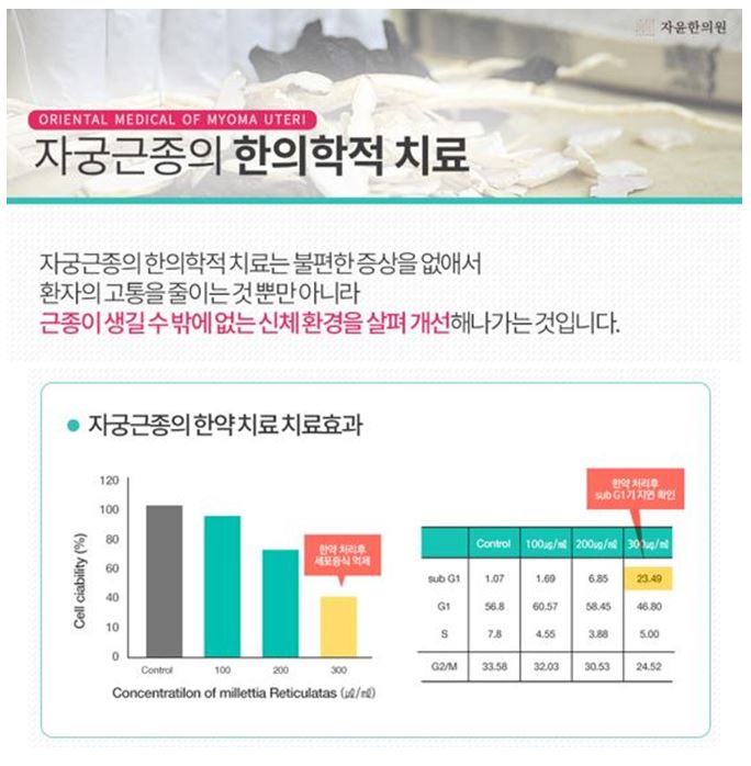  안양자궁근종 한약 복용해도 커지지 않습니다.