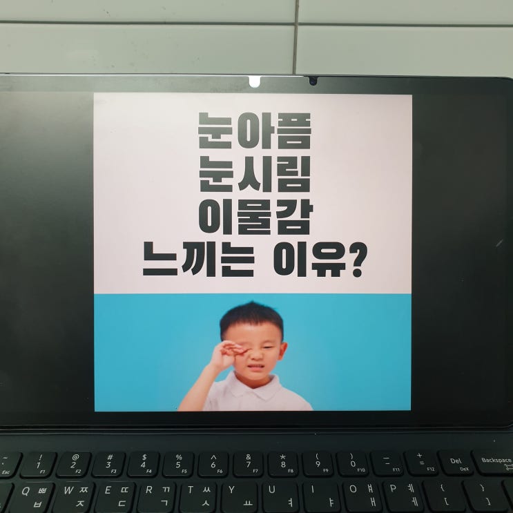  눈아픔, 눈시림, 이물감 느끼는 이유? 원인 증상 해결까지