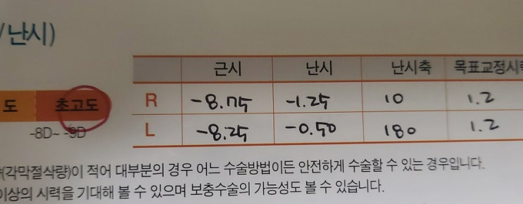  07. 안내렌즈(알티산)제거 3주 경과 진료 후기(서울성모병원)/렌즈 제거 후 도수가 더 높아지는 이유