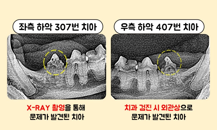  광주 고양이 치과 - 우리 냥이 치아가 녹고 있다고요!? [광주 치과 동물병원, 고양이 FORL, 고양이 치주질환, 고양이 치아흡수성병변, 고양이 치과치료, 고양이 발치]
