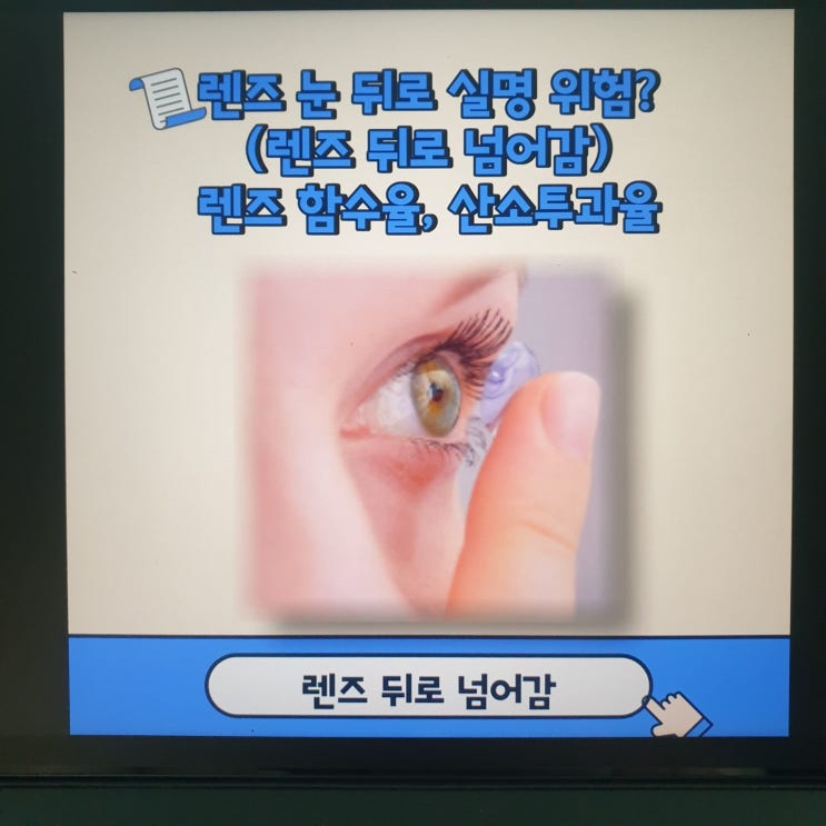 렌즈 눈 뒤로 실명 위험?(뒤로 넘어감)