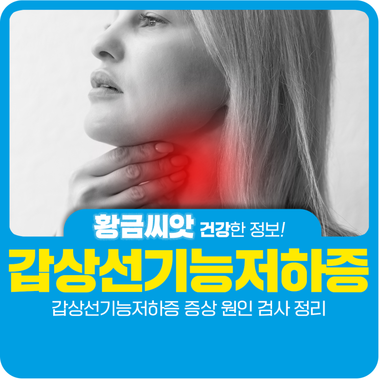  갑상선기능저하증 증상 원인 검사 정리