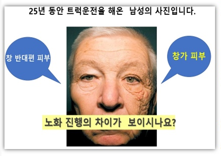 두 얼굴의 광선 자외선