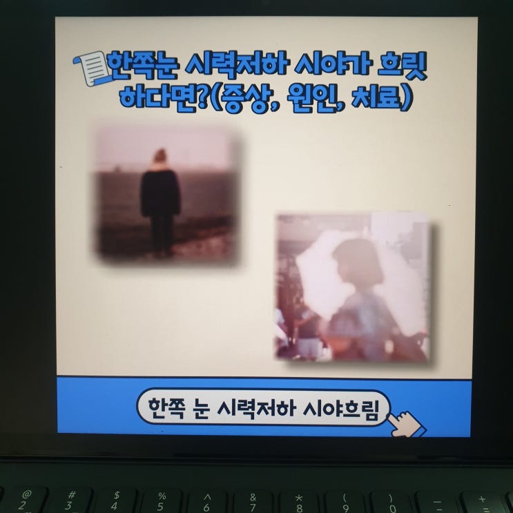 한쪽눈 시력저하 시야가 흐릿 하다면?(증상, 원인, 치료)