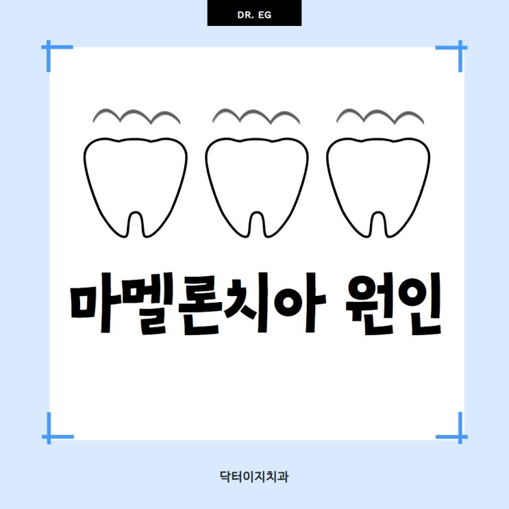  울퉁불퉁한 마멜론 치아 (절연결절)는 꼭 제거해야 할까? + 원인과 치료 방법까지 확인하세요.