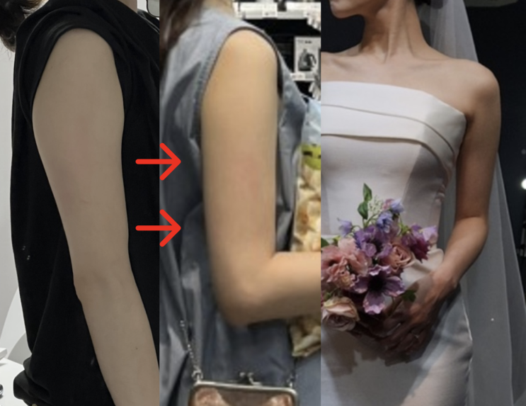  효과 전후비교- 다시찐 팔뚝살 줄이기! 일자 팔뚝 성공. 올리브영 괄사 추천 [페이스팩토리 바디 괄사]