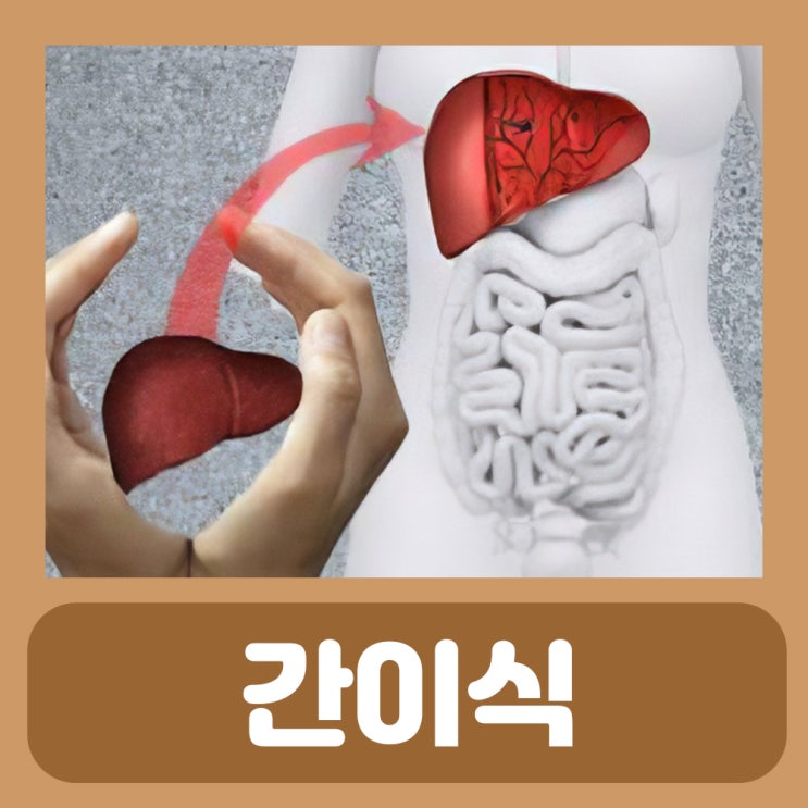  간이식 후유증 수술 비용 혈액형 조건