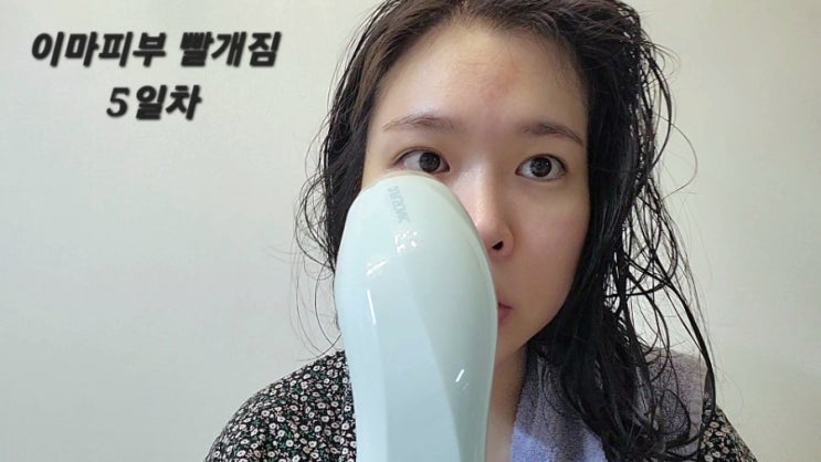  듀얼소닉 맥시멈 2주 솔직후기+이마 피부 부작용