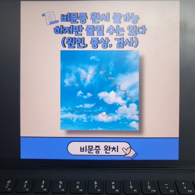  비문증 완치 불가능 하지만 줄일 수는 있다(원인, 증상, 치료, 검사)