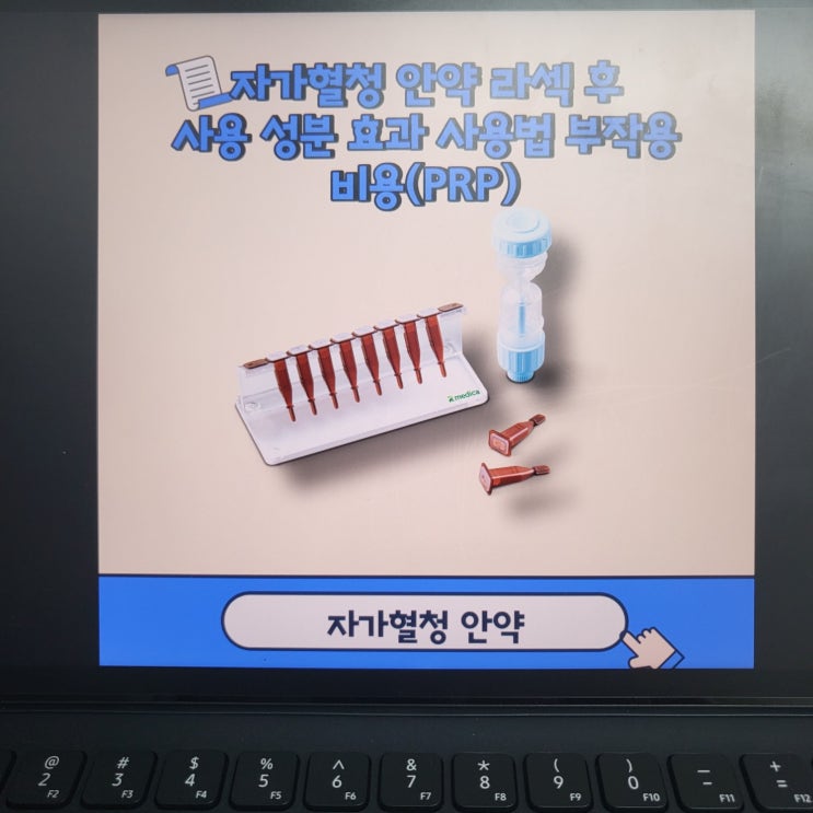  라섹 후 자가혈청 안약 사용 성분 효과 사용법 부작용 비용(PRP)