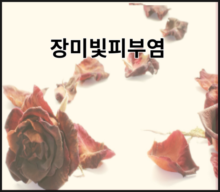  장미색비강진 장미빛비강진 잔비늘증