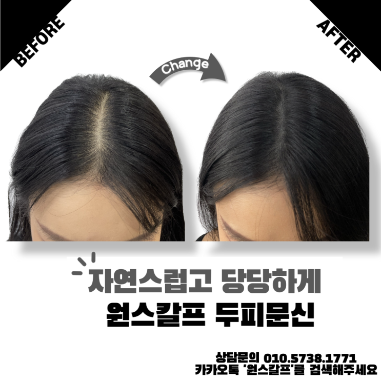  서면두피문신, 우리가 4년연속 1등인 이유?