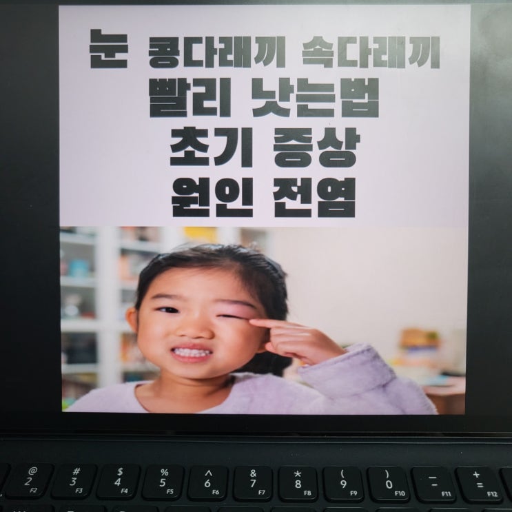  눈 콩다래끼 속다래끼 빨리 낫는법 초기증상 원인 전염