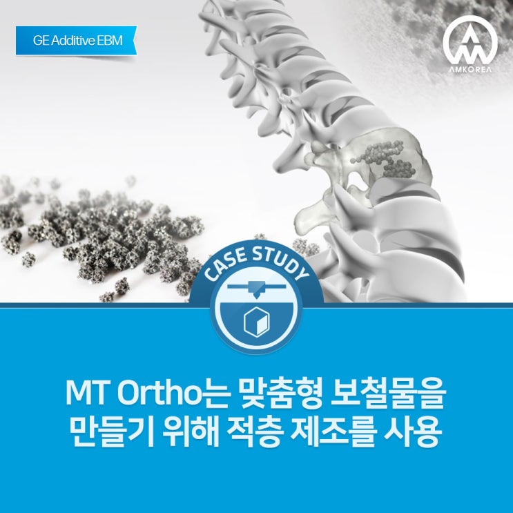  [GE Additive] MT Ortho는 정형외과 맞춤형 보철물을 만들기 위해 적층 제조를 사용