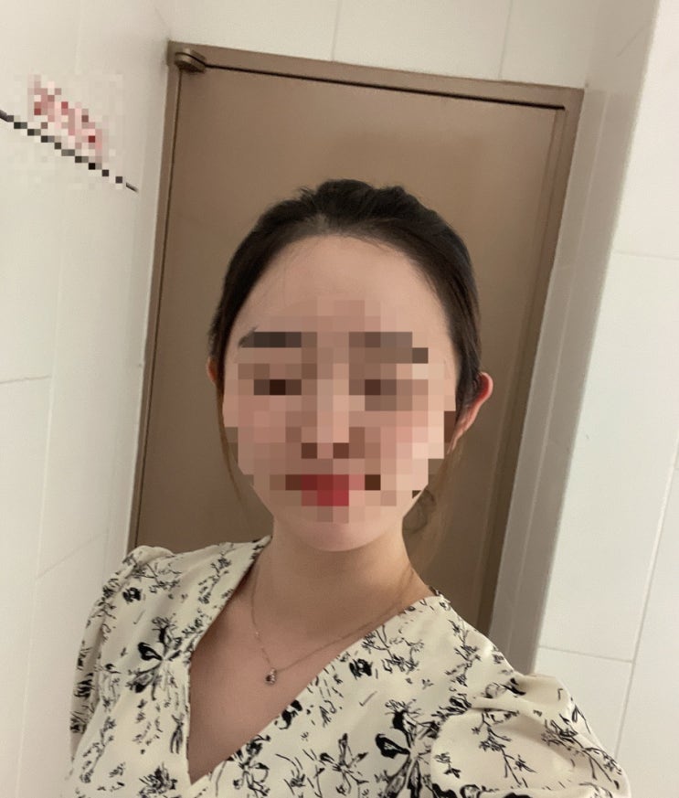  분당헤어라인 잘하는 곳 서현역 두피공방 1차 후기