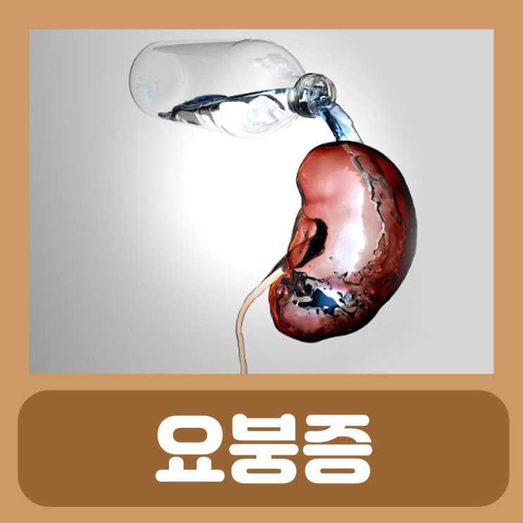  요붕증 증상 치료제 소변 자주 마려움