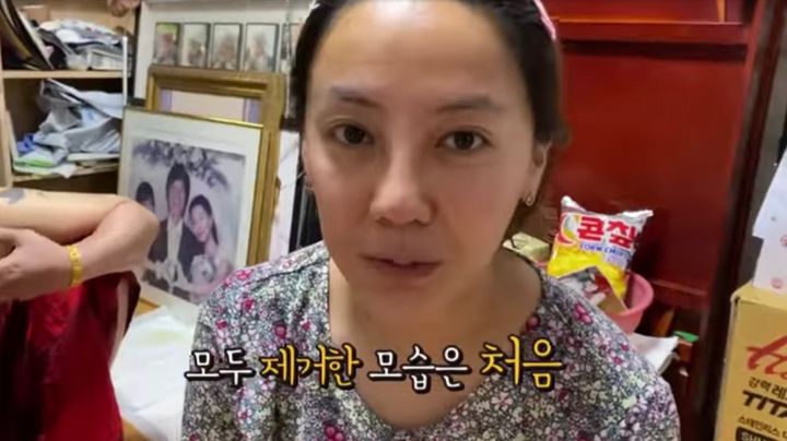 "성형 중독 아니야" 고은아, 코 재수술 후 처음 모습 공개..."아직 얼굴 부어 있다"