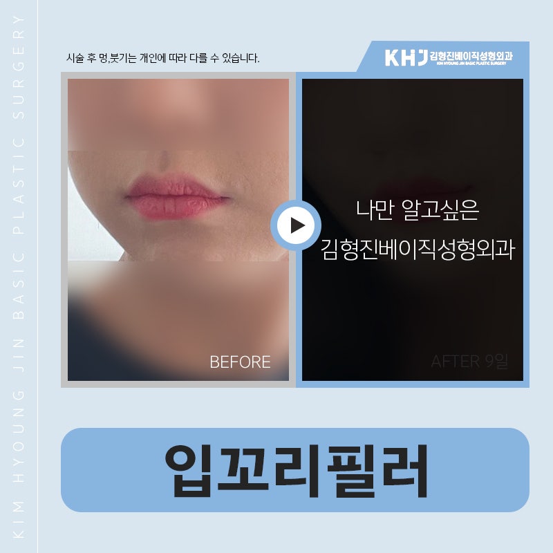 입꼬리올리는법 이렇게나 간단해 : 네이버 블로그