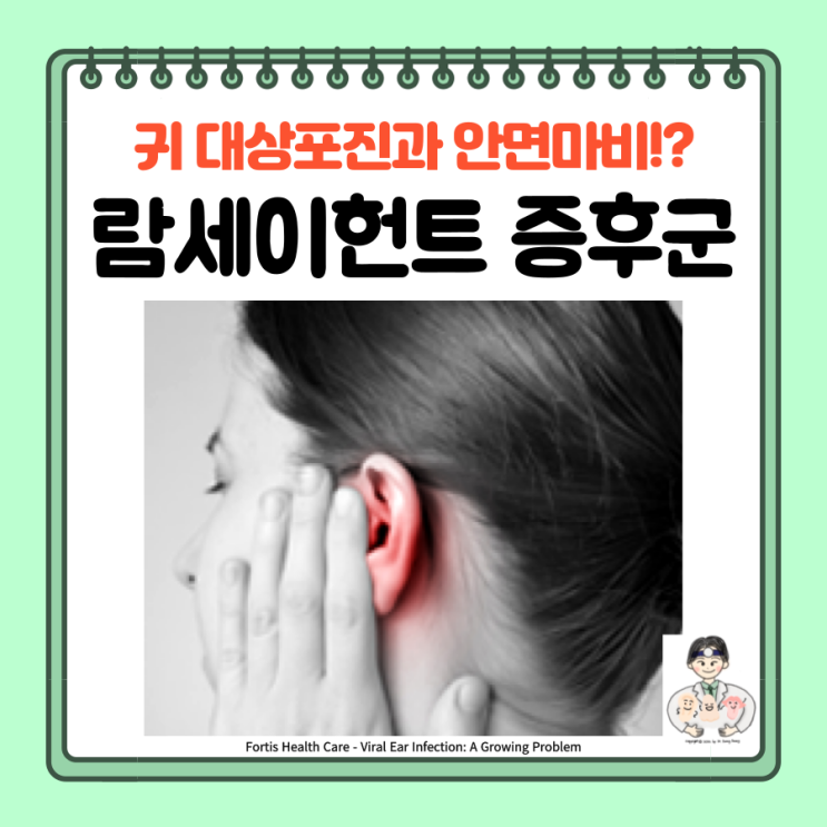 람세이헌트 증후군, 귀 대상포진 안면마비, 원인 분류 증상 치료 예후