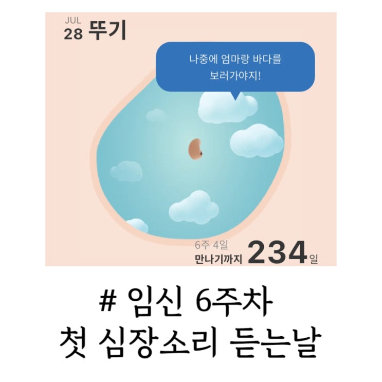  [임신일기] 임신 6주차 콩닥콩닥 첫 심장소리 들으러 간 날
