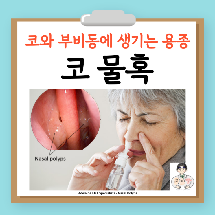  코 물혹, 폴립, 비용종 원인 증상 검사 치료 수술